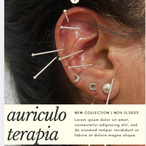 AURICULOTERAPIA