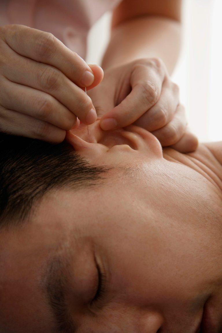 Sesión de Auriculoterapia
